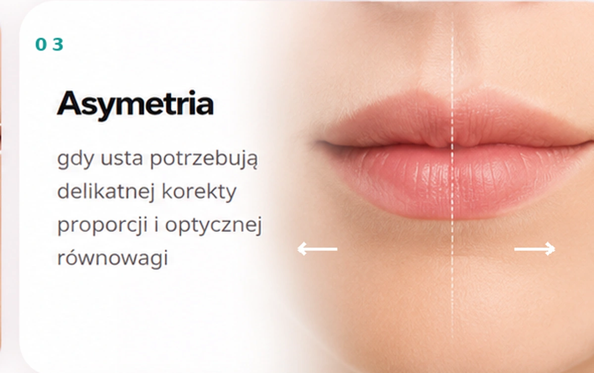Asymetria — gdy usta potrzebują delikatnej korekty proporcji i optycznej równowagi