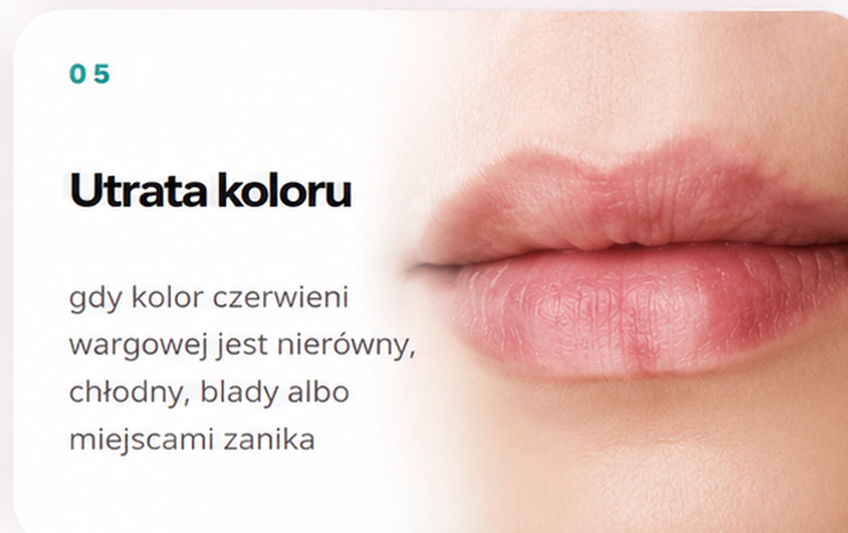 Utrata koloru — gdy kolor czerwieni wargowej jest nierówny, chłodny, blady albo miejscami zanika