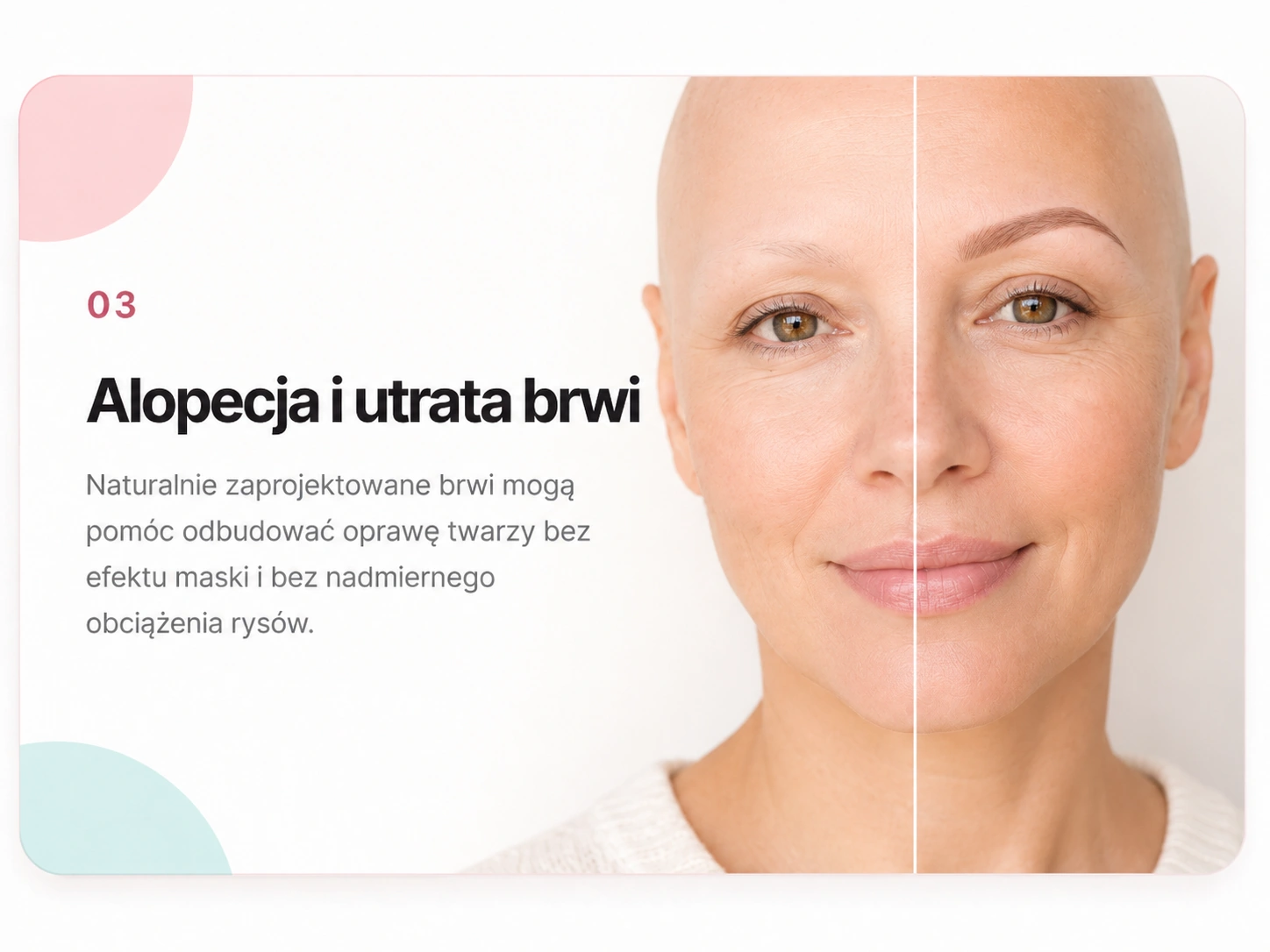 Alopecja i utrata brwi — naturalna odbudowa oprawy twarzy